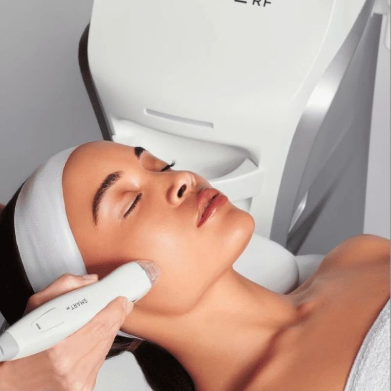Lifting facial VirtueRF la clinica Age Control din Chișinău